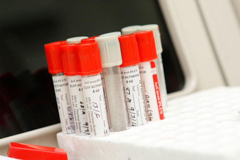 Free Home Sample Collection Eden Medical Centre